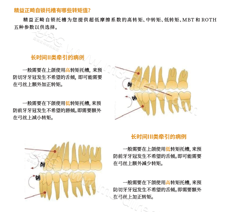 第六代托槽_画板-1-副本_11.png