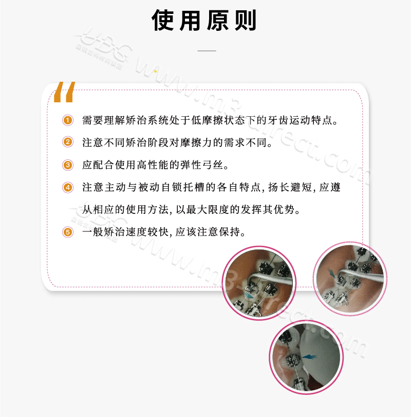 第六代托槽_画板-1-副本_13.png
